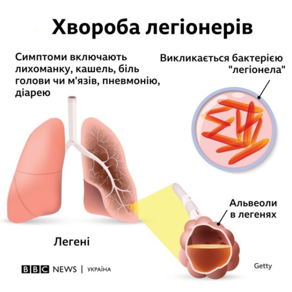 хвороба легіонерів