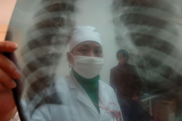 A new study by Cleveland Clinic researchers suggests eating red meat could increase a person's risk of a potentially deadly abdominal aortic aneurysm. File Photo by Shou Sheng/EPA